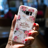 Thin TPU Cases | Different Designs to Choose from | Compatible with Samsung and Redmi